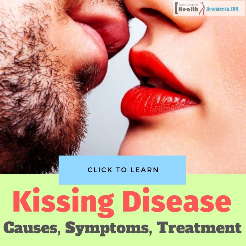 Kissing Disease
