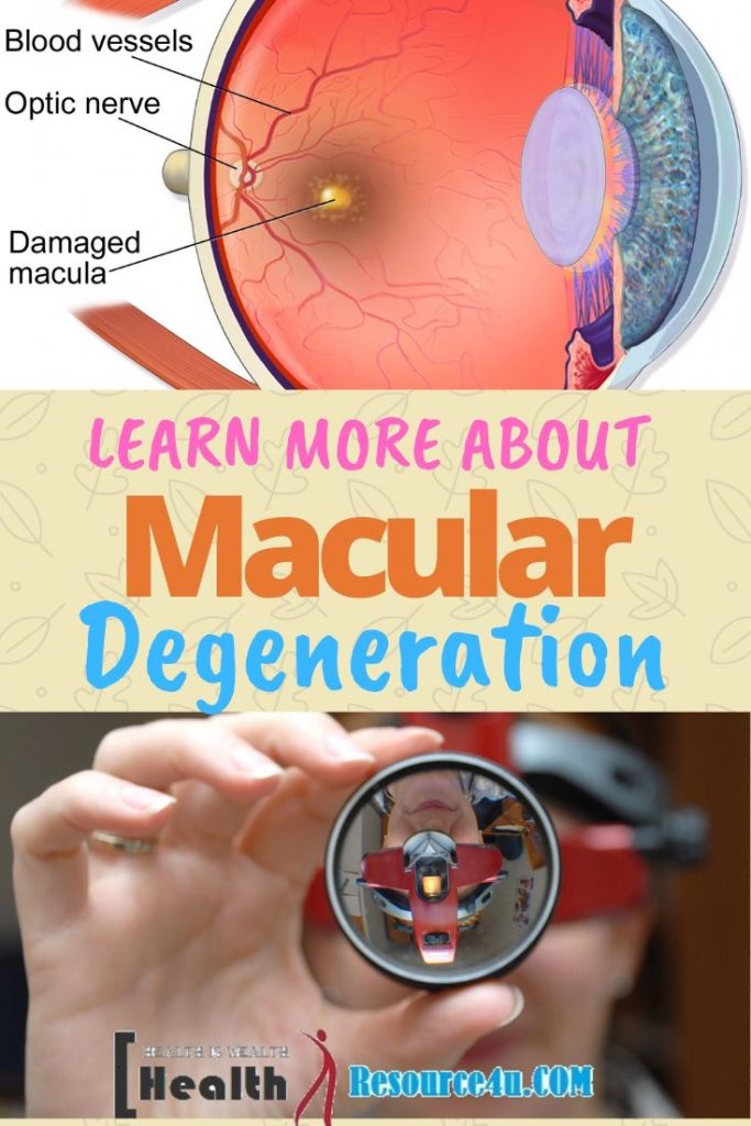 Macular Degeneration Causes Treatment