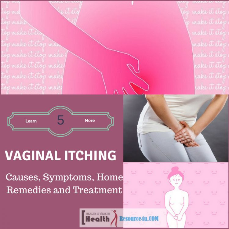 Vaginal Itching