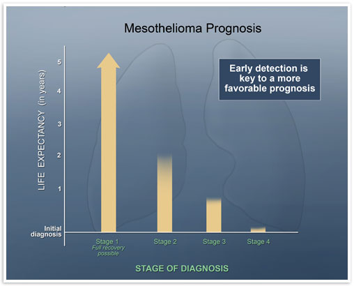 mesothelioma prognosis stages