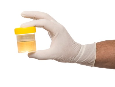 Diluted Urine