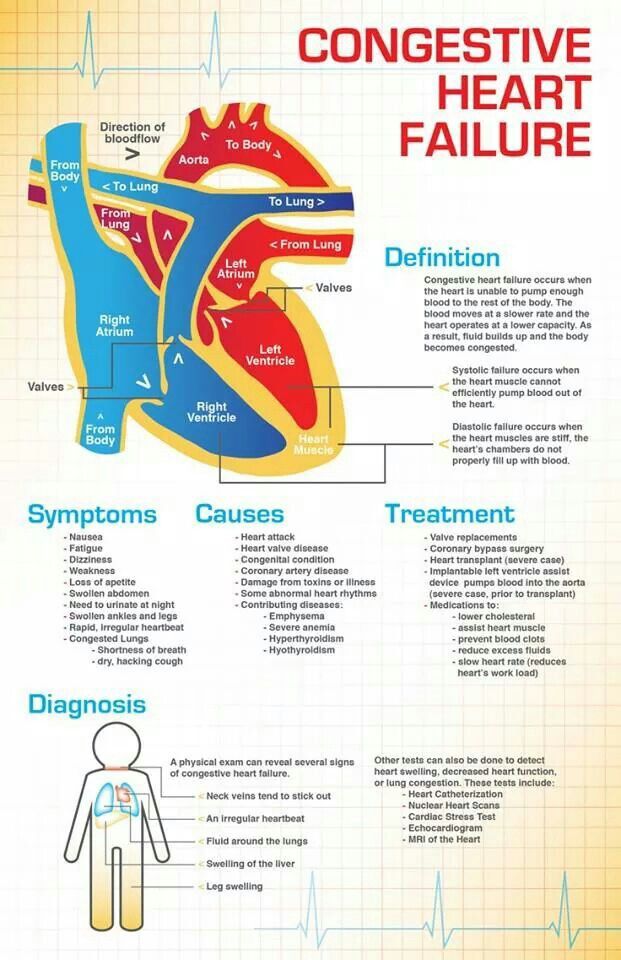 Congestive Heart Failure infographic