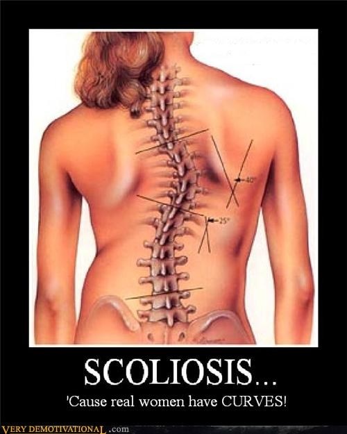 Scoliosis poster