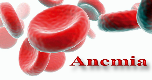 Anemia