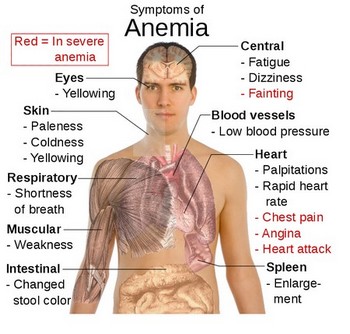 Anemia Symptoms