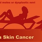 Melanoma Skin Cancer Symptoms