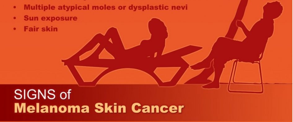 Melanoma Skin Cancer Symptoms