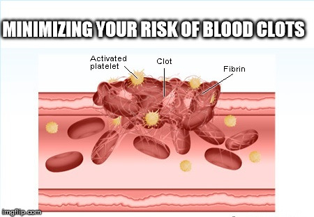 Minimizing Your Risk of Blood Clots