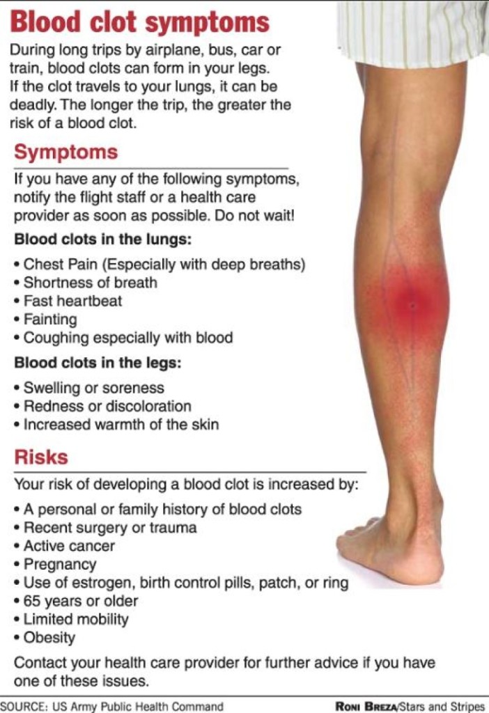 blood clot symptoms