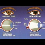 Pupil Response to Light
