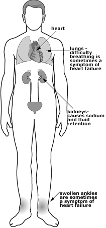 Symptoms of Hypervolemia