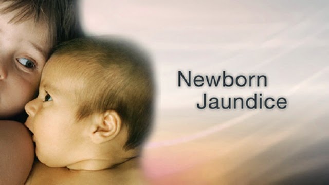 Neonatal Jaundice in Newborn