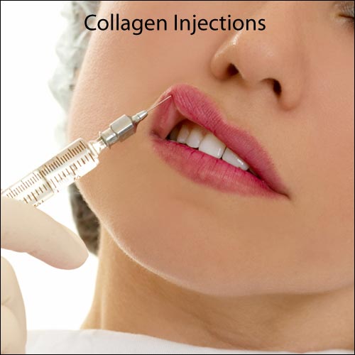 Collagen Injections