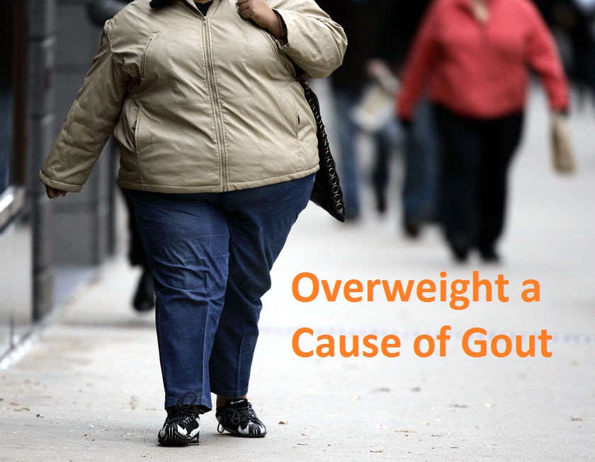 Overweight a Cause of Gout