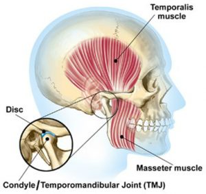 TMJ