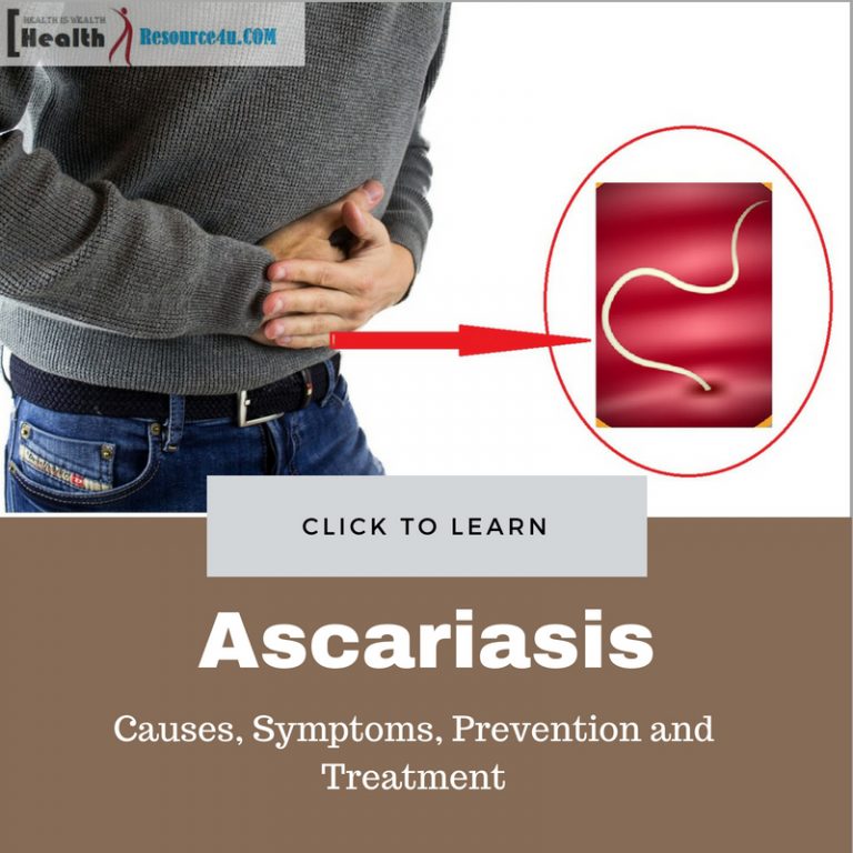 Ascariasis Causes, Symptoms