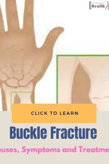 Buckle Fracture causes treatment