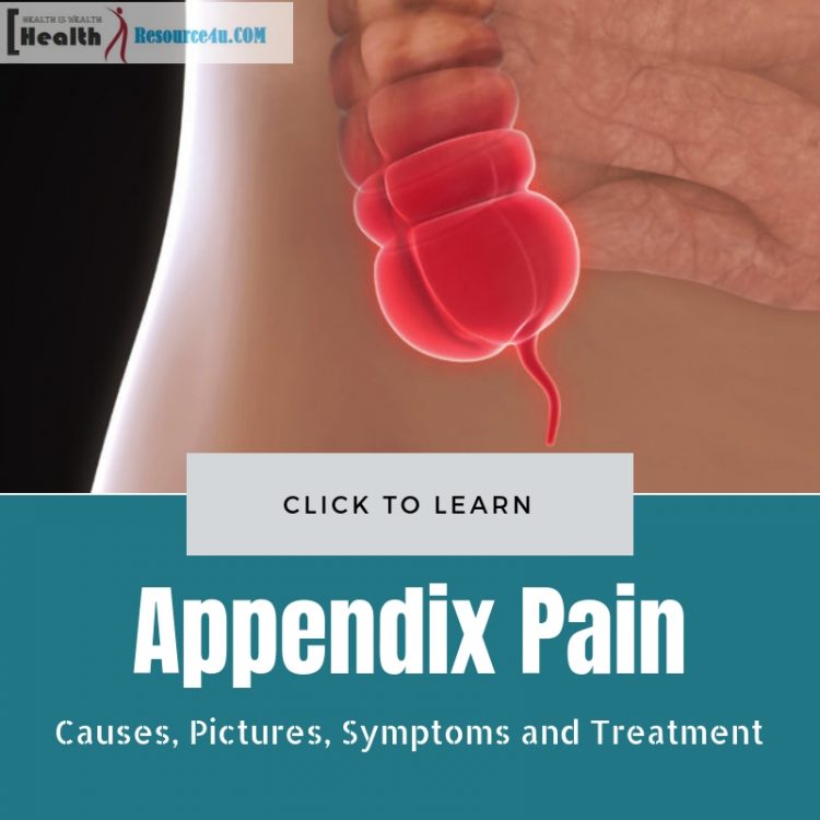 Appendix Pain : Causes, Pictures, Symptoms And Treatment