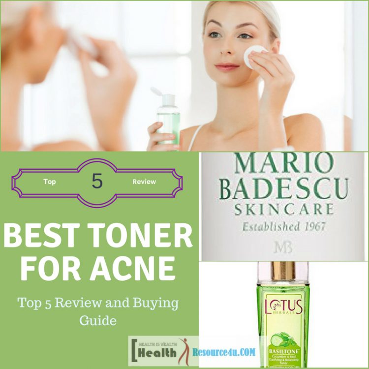 Best Toner for Acne Prone Skin