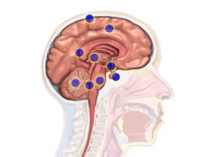 Types of Treatment Pituitary Adenomas