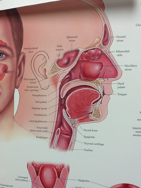 sinus-headaches