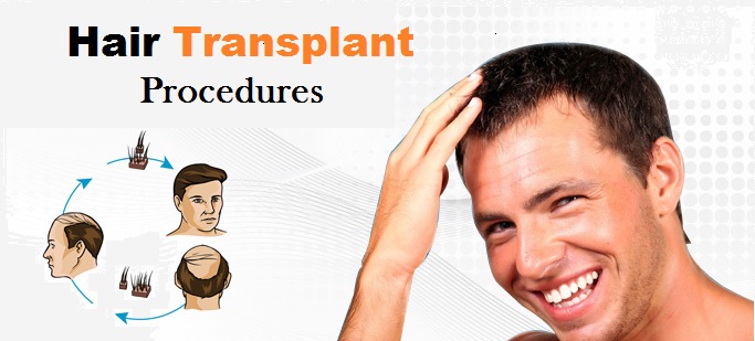 Hair Transplant Procedures