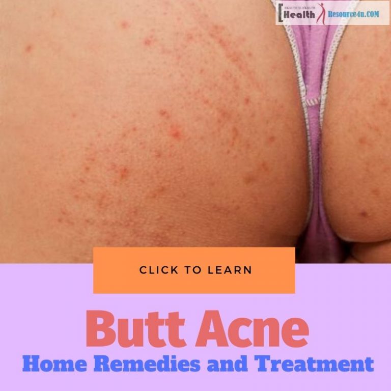 How To Get Rid Of Butt Acne