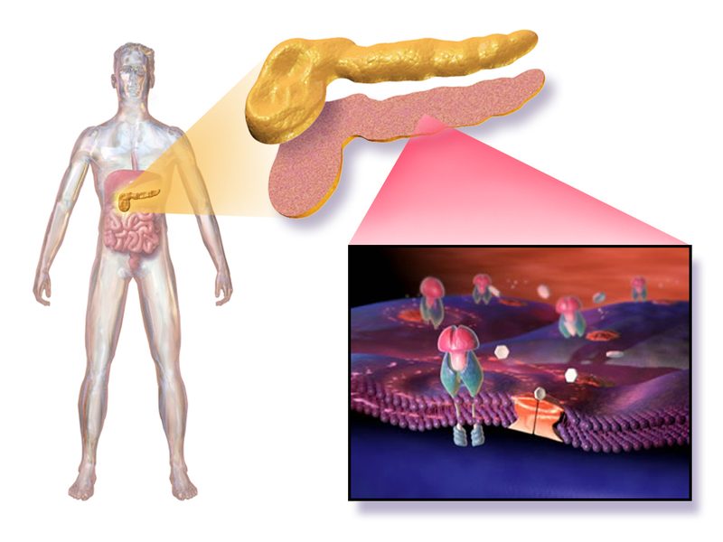 Diabetes can affect every part of the body