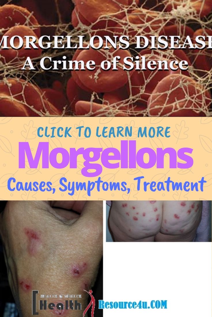 Morgellons Disease Picture