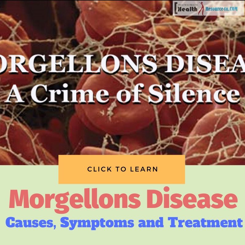 Morgellons Disease