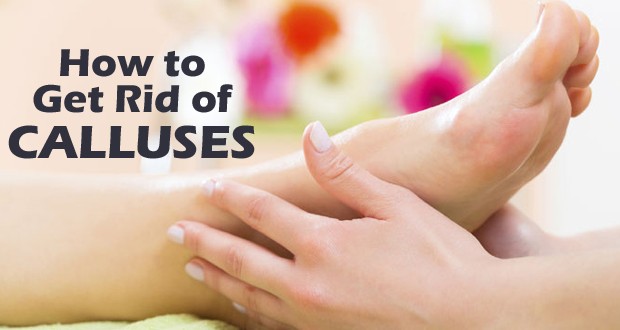 How to Remove Hard Calluses from Feet?