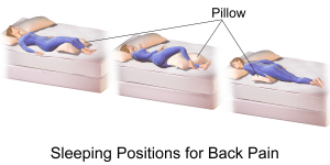 Sleeping Positions for Back Pain