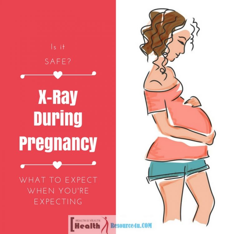 X Rays During Pregnancy e1524111662495
