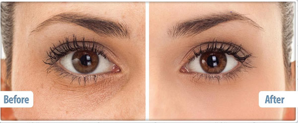 how does revitalizing eye cream work