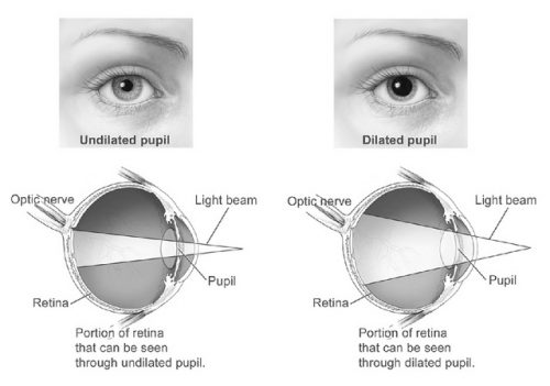 Cluster Headaches