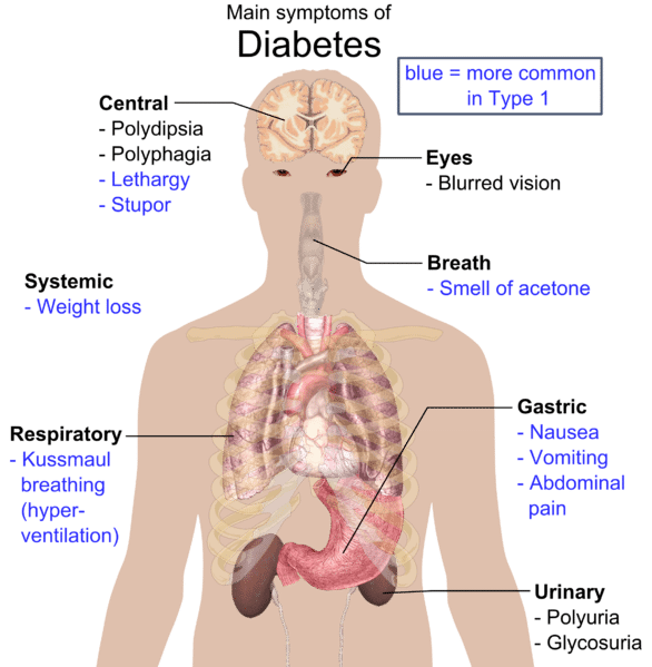 How Diabetes Damages The Brain