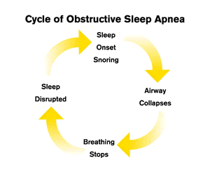 Cycle of sleep apnea