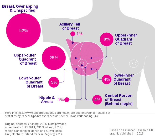 Kinds of Breast Cancer