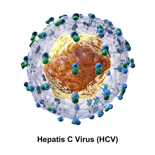 Hepatitis C