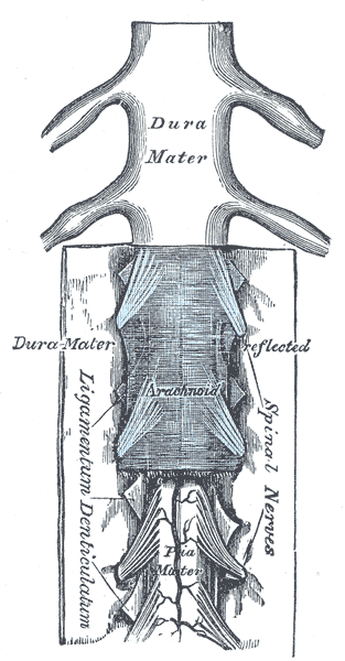 Chronic spine inflammatory