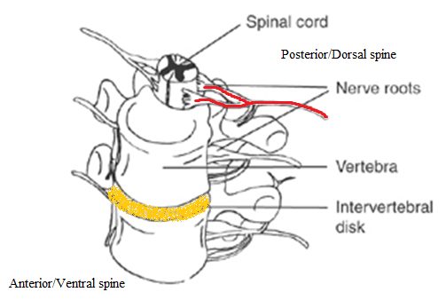 Cauda Equina Syndrome