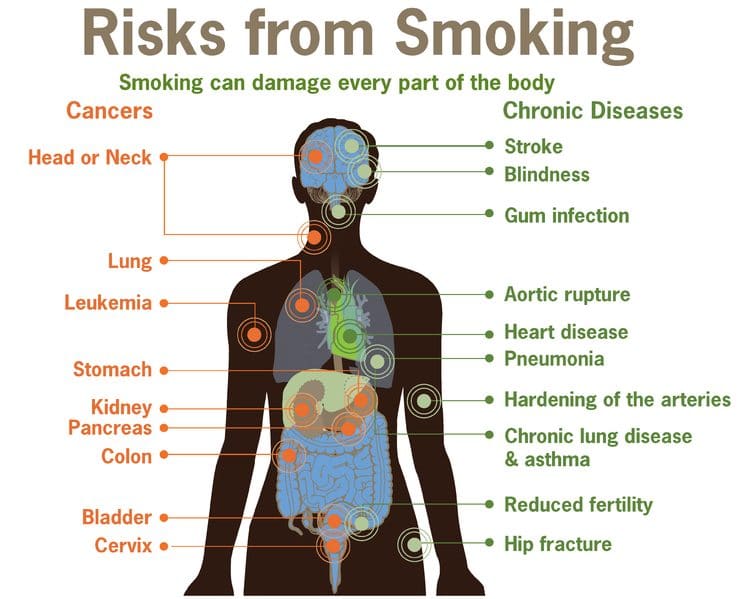 745px Risks form smoking smoking can damage every part of the body