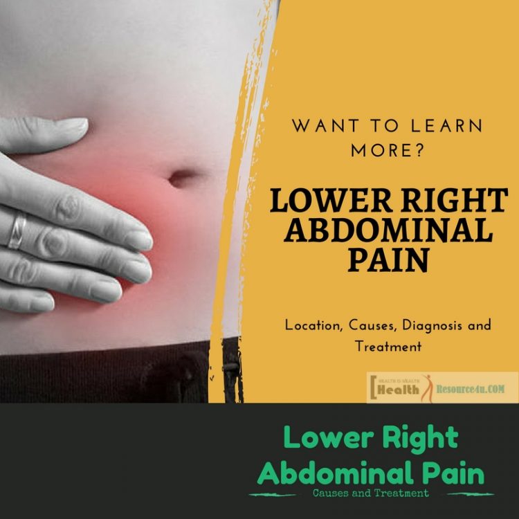 Lower Right Abdominal Pain e1521445039772