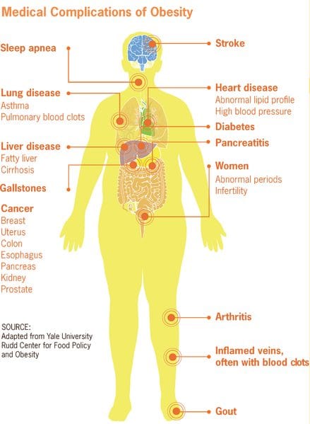 Obesity and Its Linkage to Hypogonadism