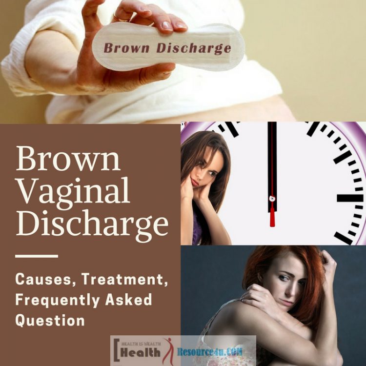 Brown Vaginal Discharge e1525852959812