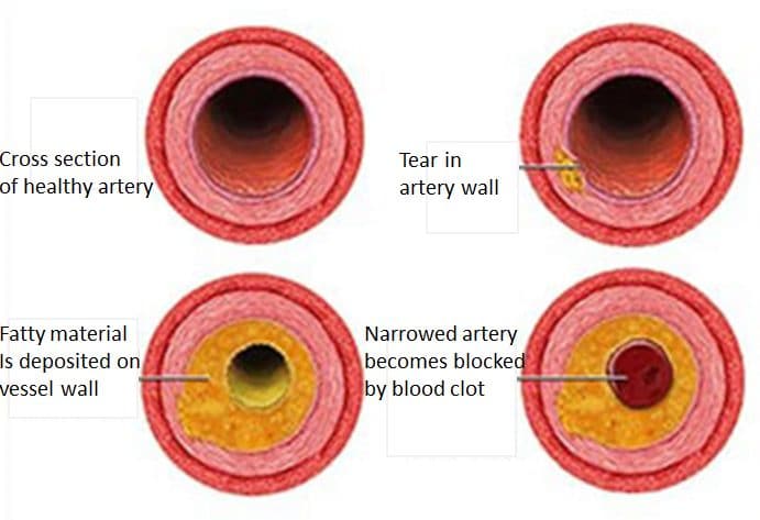 Reduce Body Inflammation