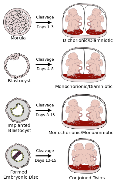 Twin pregnancy Week by Week