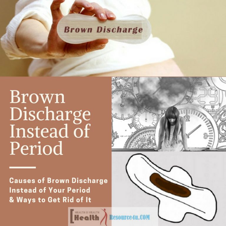 Causes of Brown Discharge Instead of Your Period