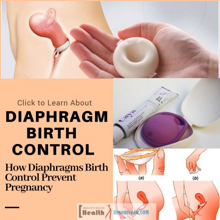 Diaphragms Birth Control Prevent Pregnancy