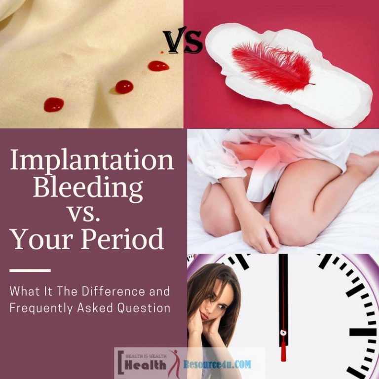 Implantation Bleeding vs. Your Period